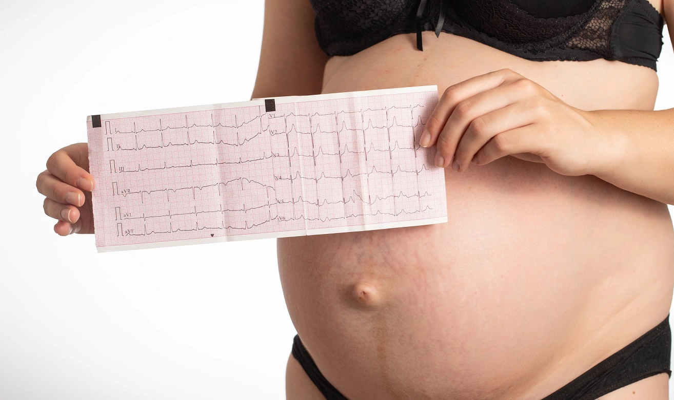 Cardiac arrhythmias during pregnancy